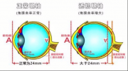 兒童近視防控“防”的是什么？孩子近視防控你真的理解嗎？